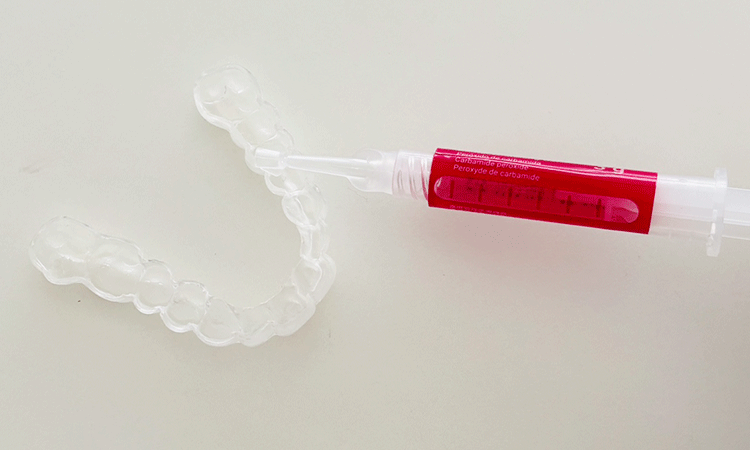 お口全体のチェック