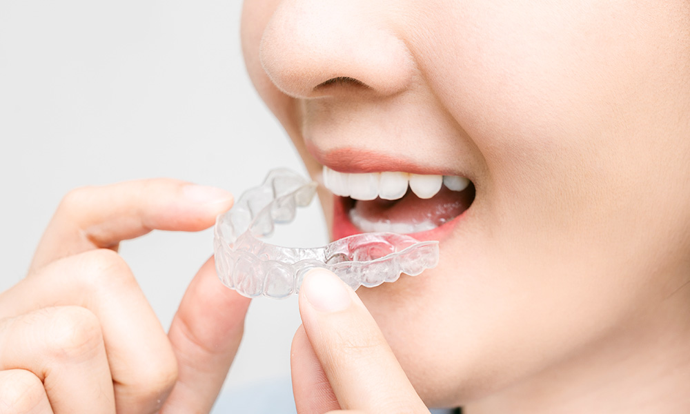 お口全体のチェック