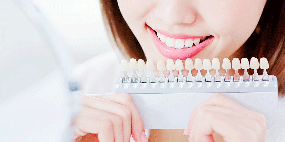 画像のタイトル