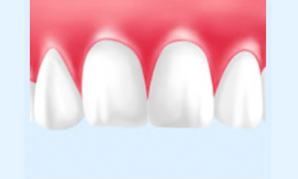 お口全体のチェック