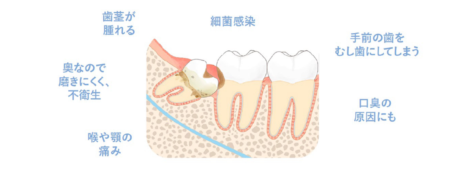 画像のタイトル