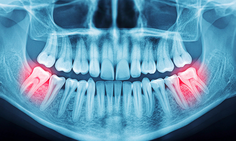 お口全体のチェック