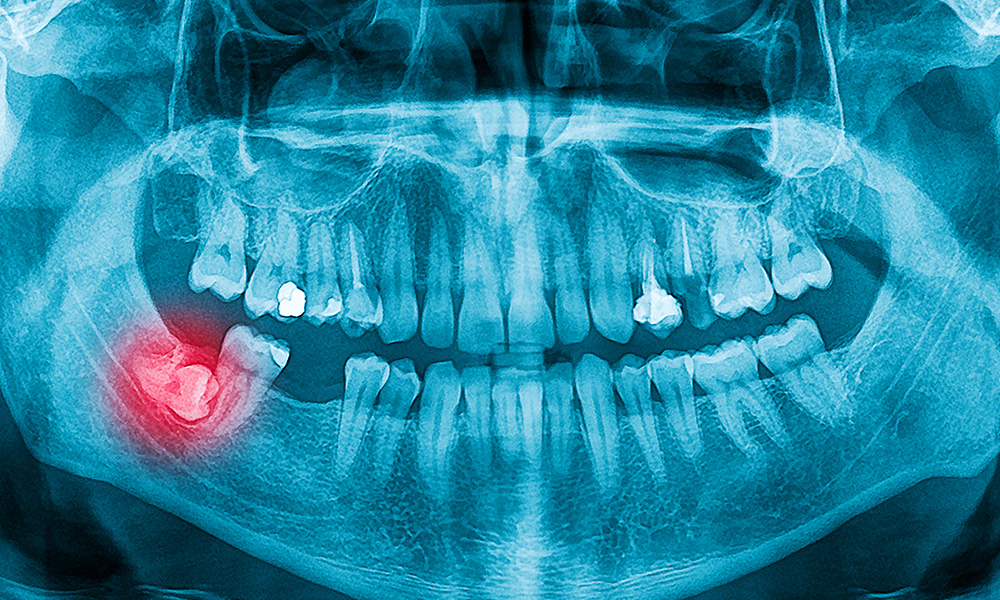 お口全体のチェック