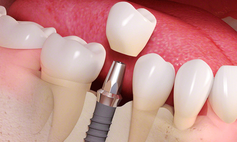 小児歯科・小児矯正・妊婦さんの治療