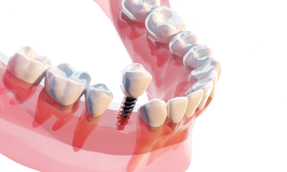 小児歯科・小児矯正・妊婦さんの治療