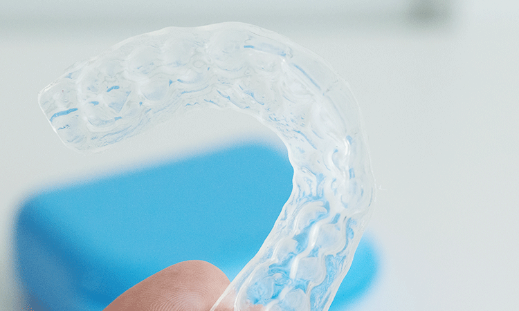 お口全体のチェック